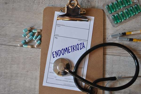 Endometrioza a nowotwór - poznaj opinię eksperta.